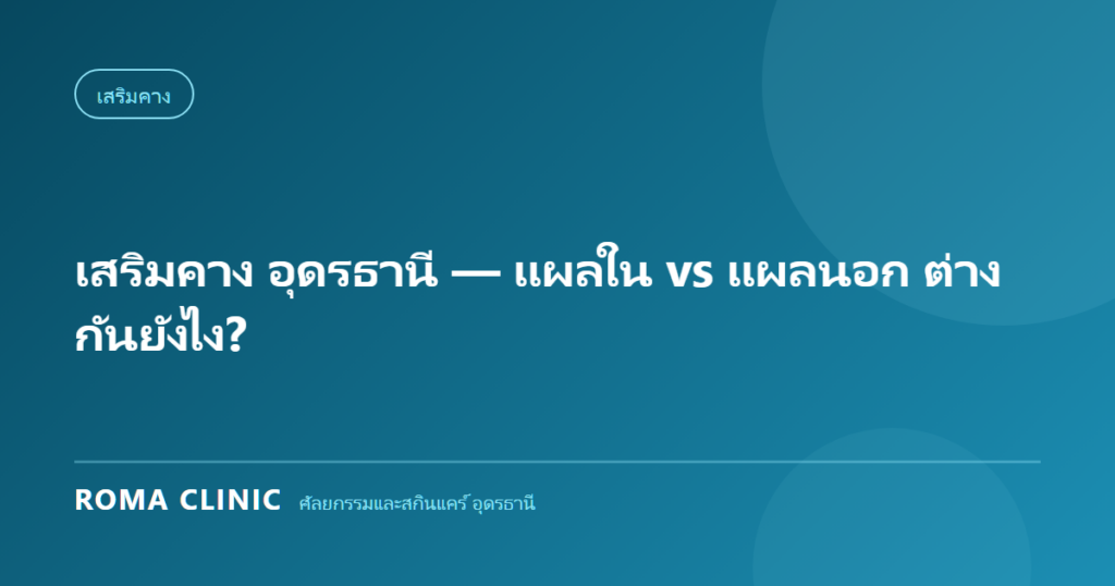เสริมคาง อุดรธานี — แผลใน vs แผลนอก ต่างกันยังไง?