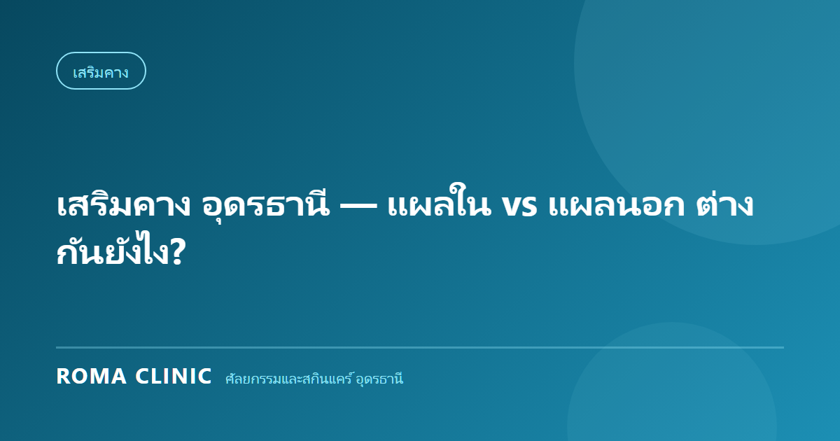 เสริมคาง อุดรธานี — แผลใน vs แผลนอก ต่างกันยังไง?