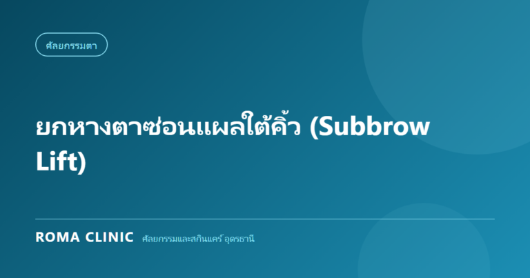 ยกหางตาซ่อนแผลใต้คิ้ว (Subbrow Lift): วิธีแก้ปัญหาหางตาตกโดยไม่ต้องทำตาสองชั้น