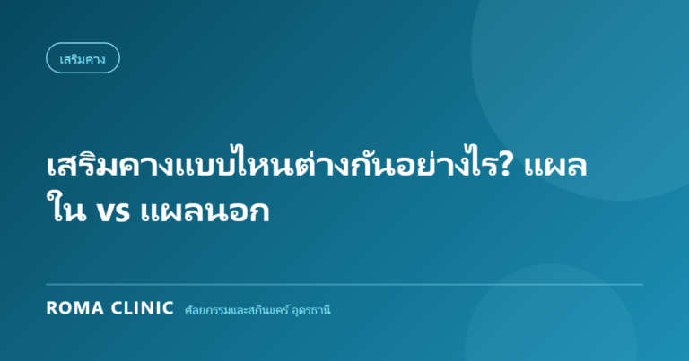 เสริมคางแบบไหนต่างกันอย่างไร? แผลใน vs แผลนอก