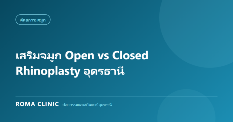 เสริมจมูก Open vs Closed Rhinoplasty อุดรธานี: เทคนิคไหนเหมาะกับโครงสร้างจมูกคนอีสาน