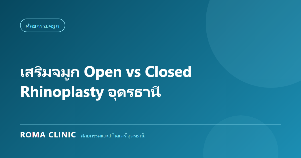 เสริมจมูก Open vs Closed Rhinoplasty อุดรธานี: เทคนิคไหนเหมาะกับโครงสร้างจมูกคนอีสาน